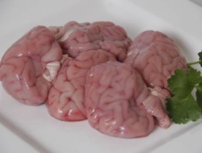 Brains